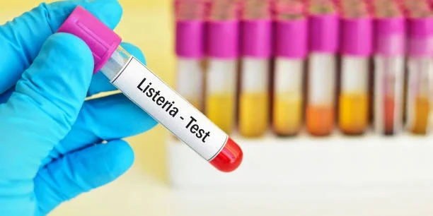 Mano con guante de laboratorio sosteniendo tubo de ensayo etiquetado "Listeria Test"