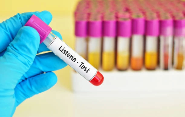 Mano con guante de laboratorio sosteniendo tubo de ensayo etiquetado "Listeria Test"